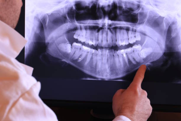 Best Emergency Dental Extractions in Palestine, TX