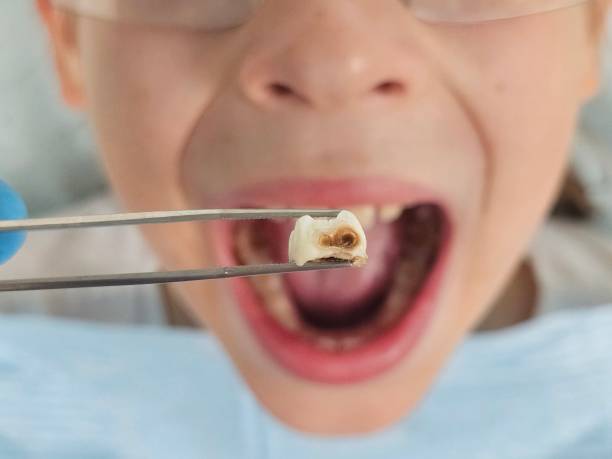 Best Pediatric Emergency Dentist in Palestine, TX